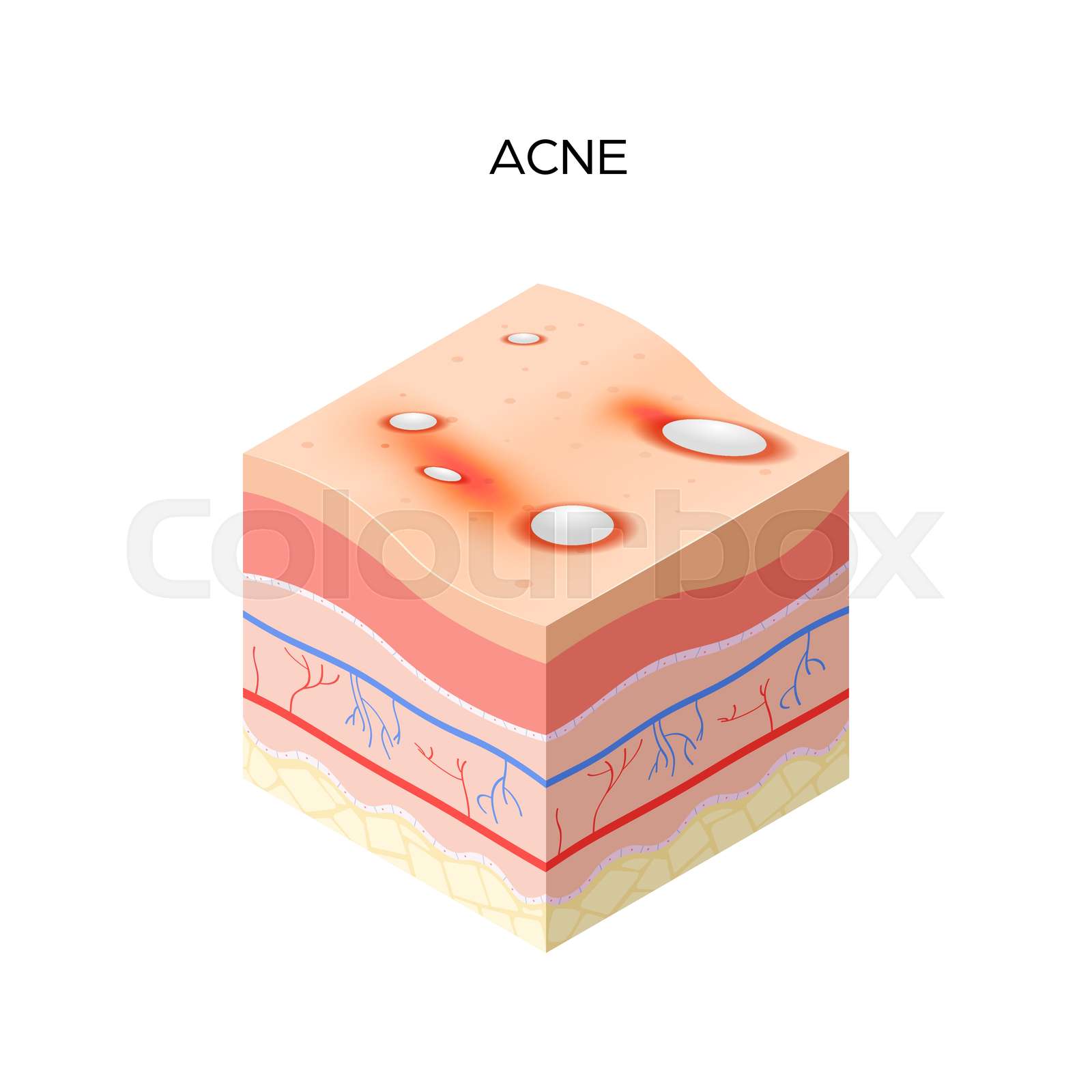 Cross Section Of Human Skin Layers Structure Skincare Medical Concept